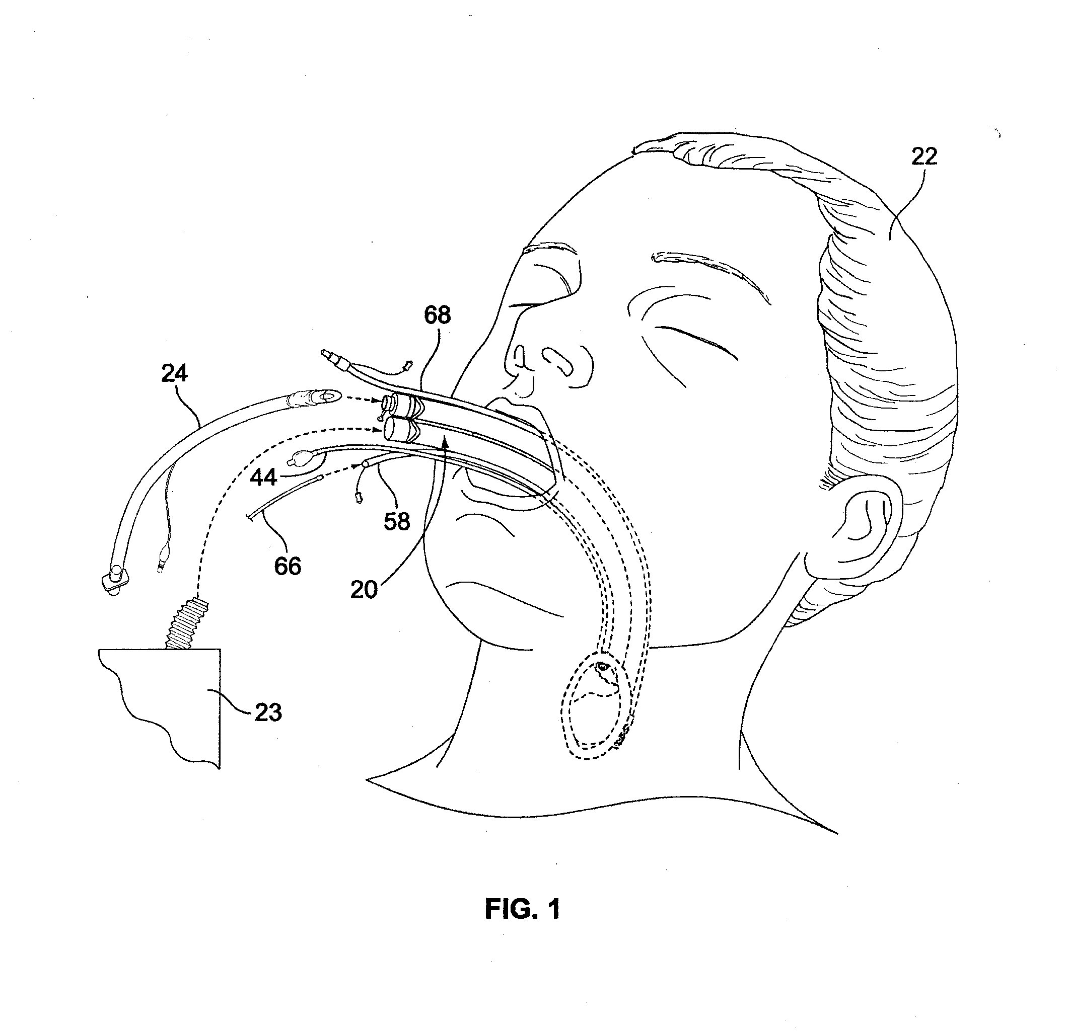 Airway device, airway assist device and the method of using same