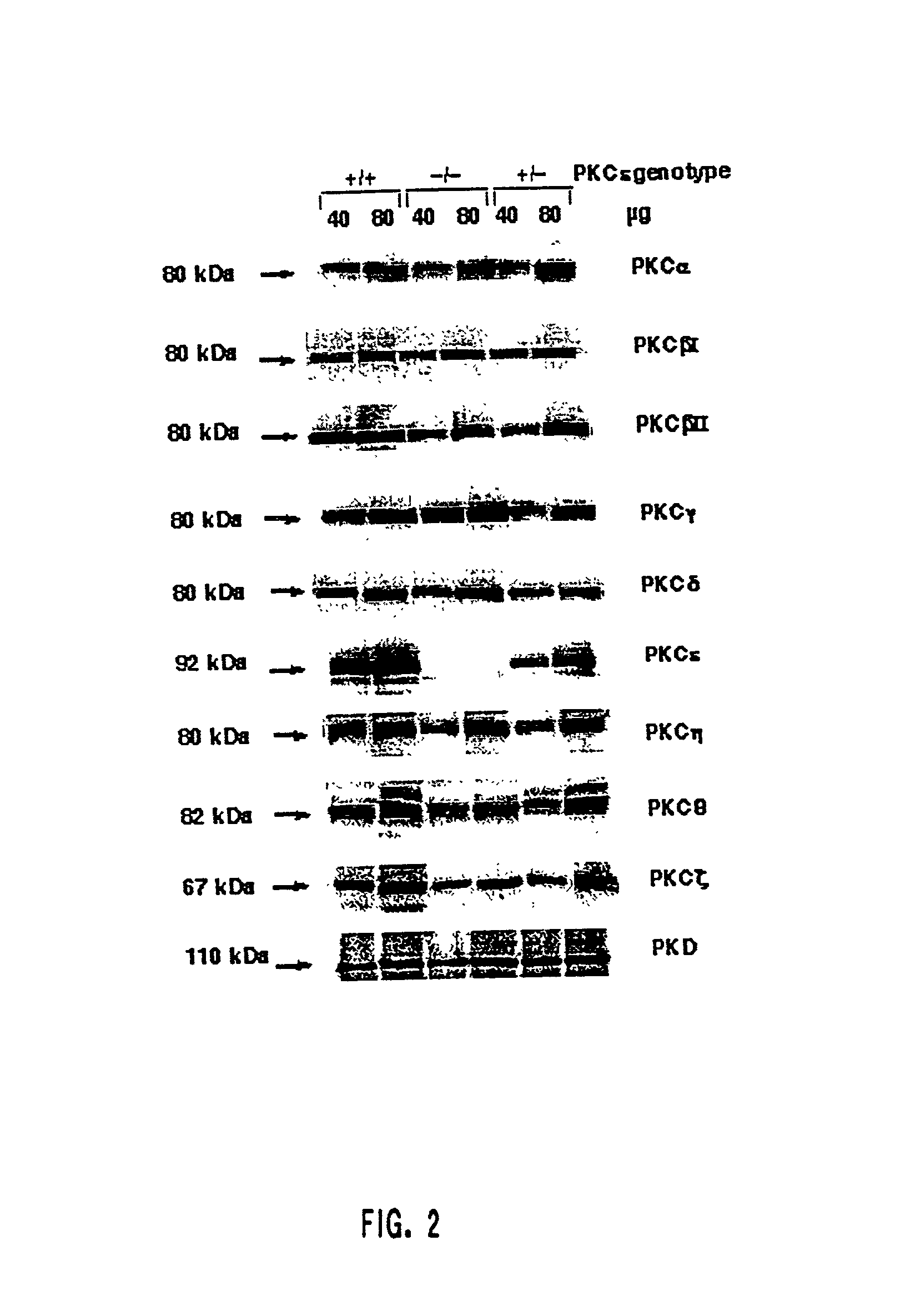 Protein kinase c epsilon as modulator of anxiety, alcohol consumption and self-administration of drugs of abuse