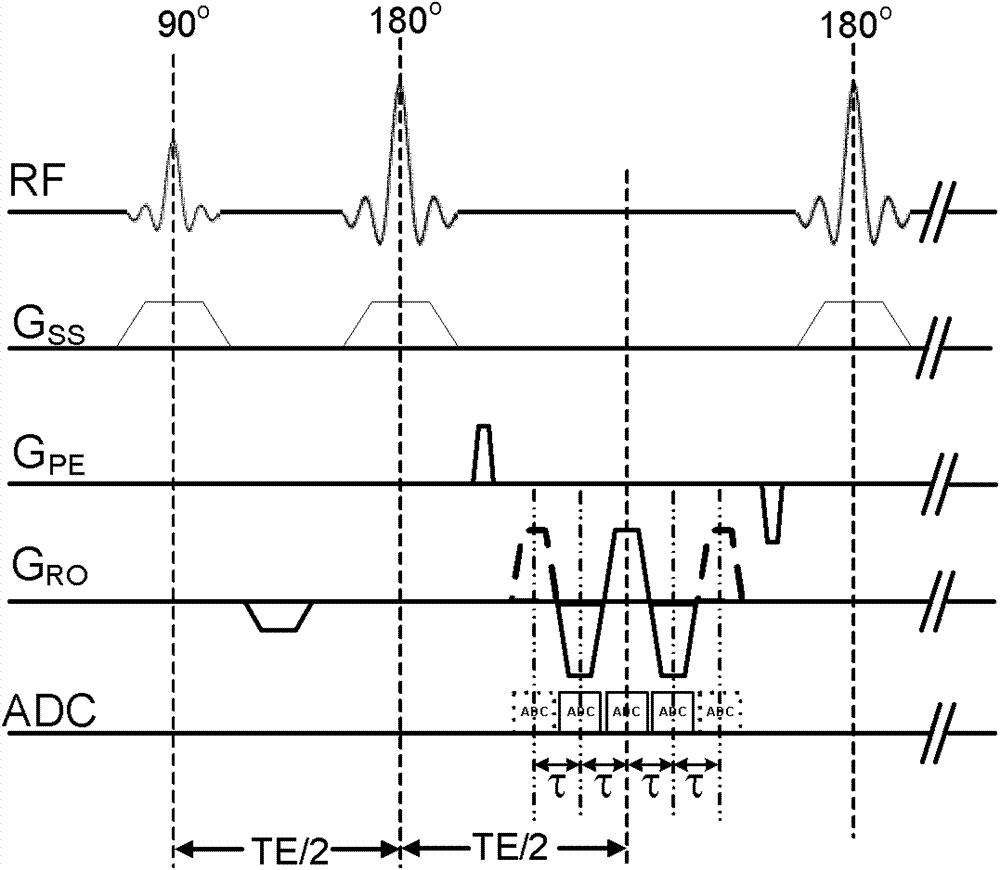 Water and fat separation method based on under-sampling k-space data