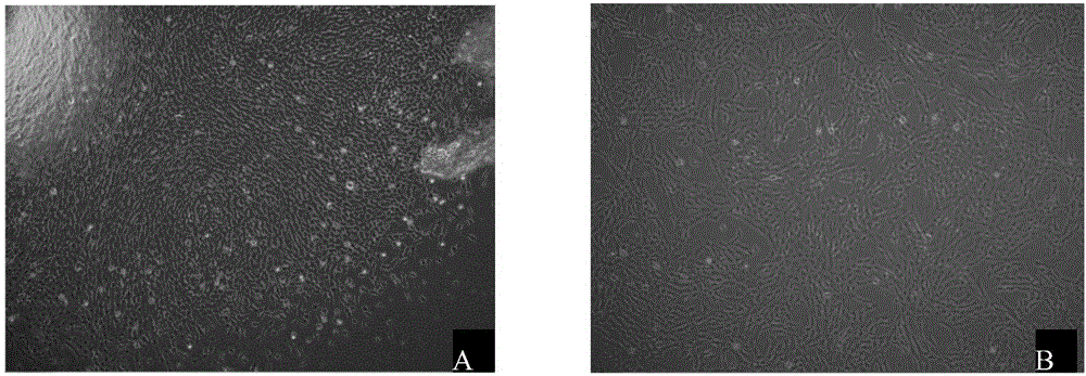 hUCMSCs (human umbilical cord mesenchymal stem cells) carrying PEDF (pigment epithelial-derived factor) and modified with recombinant lentivirus as well as preparation method of hUCMSCs