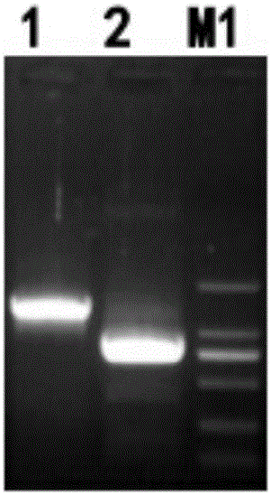 hUCMSCs (human umbilical cord mesenchymal stem cells) carrying PEDF (pigment epithelial-derived factor) and modified with recombinant lentivirus as well as preparation method of hUCMSCs