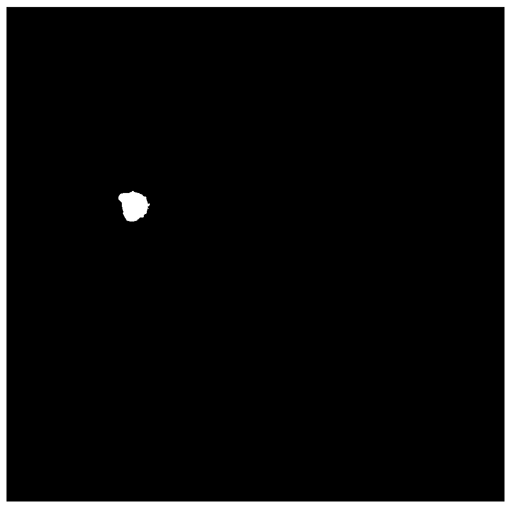 Eye fundus image recognition model training method, eye fundus image recognition method and eye fundus image recognition equipment