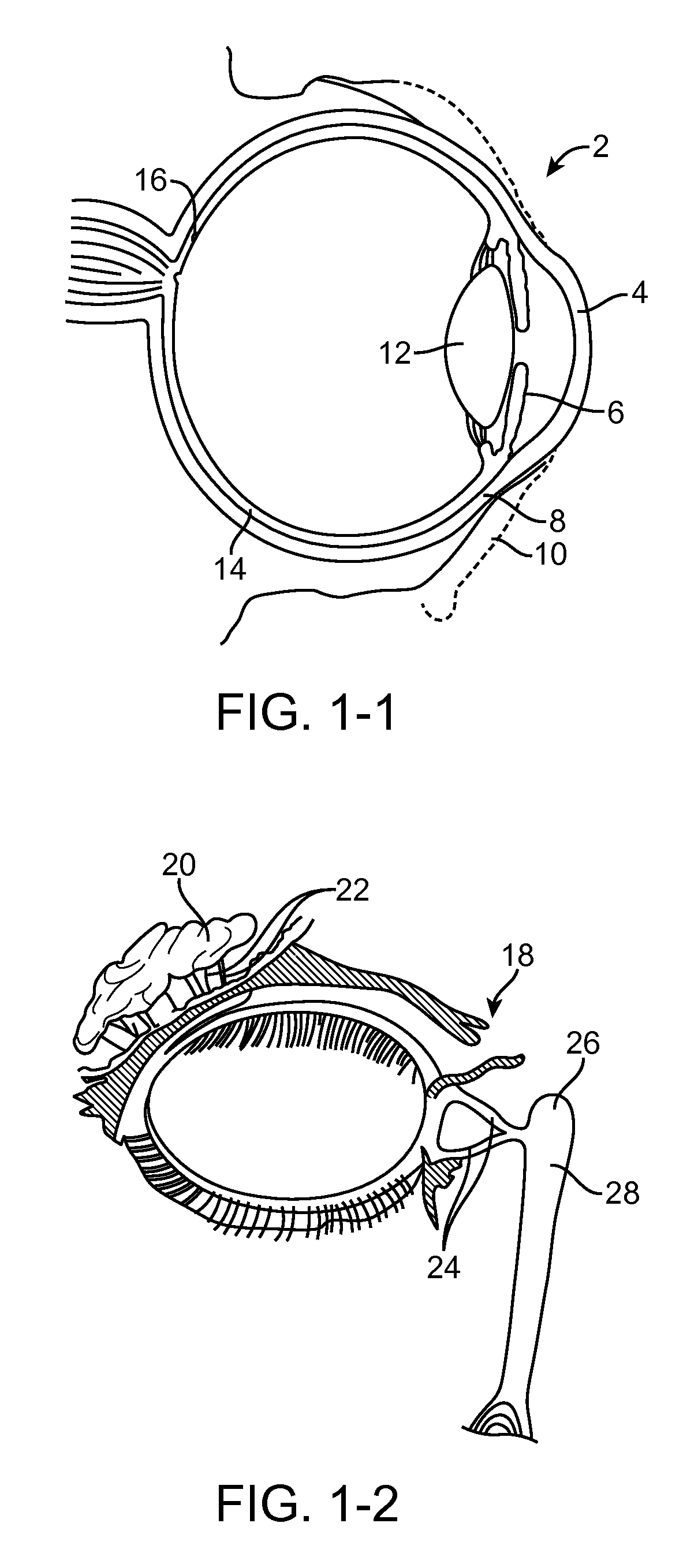 Anterior segment drug delivery