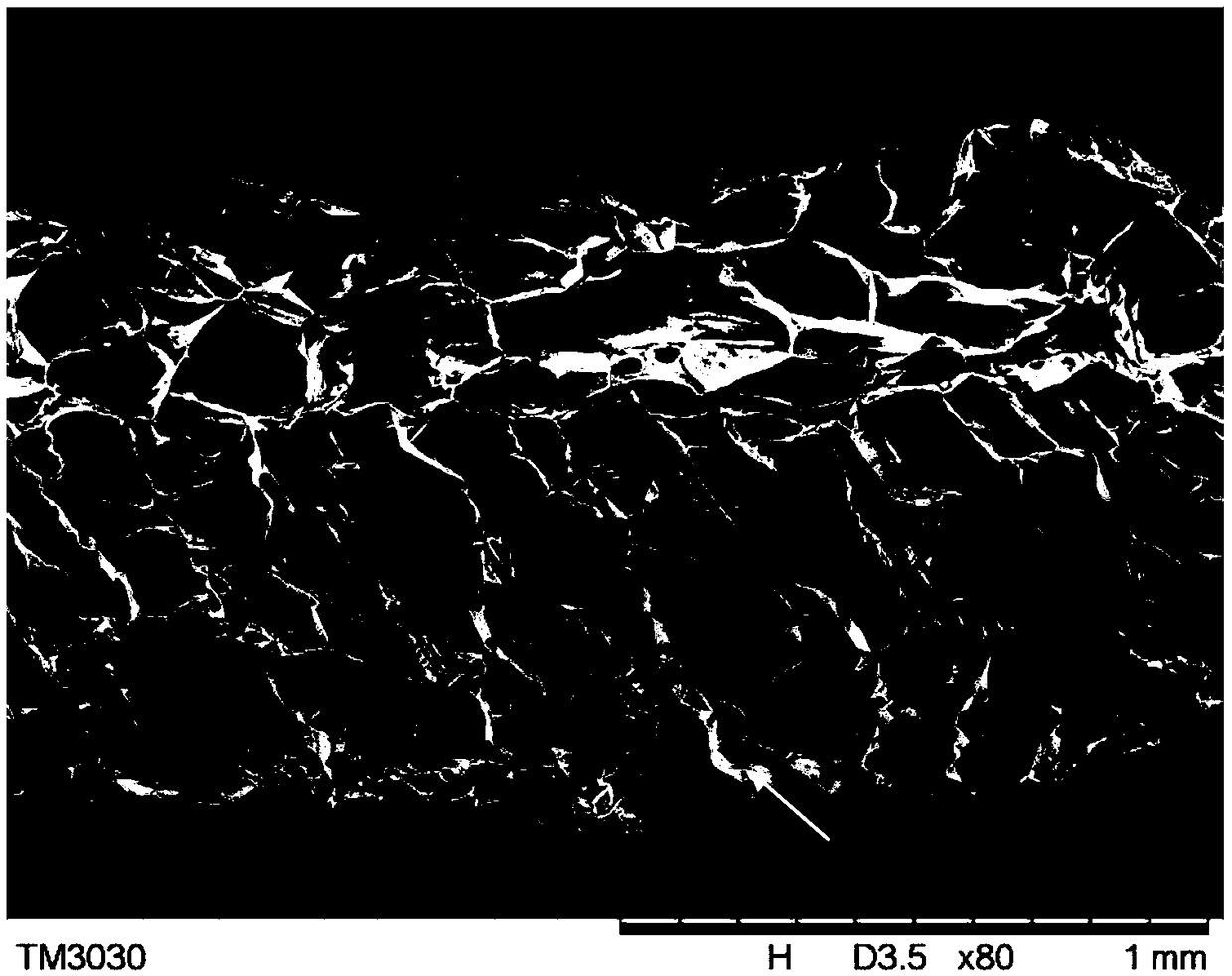 Artificial dermis repair material and preparation method thereof