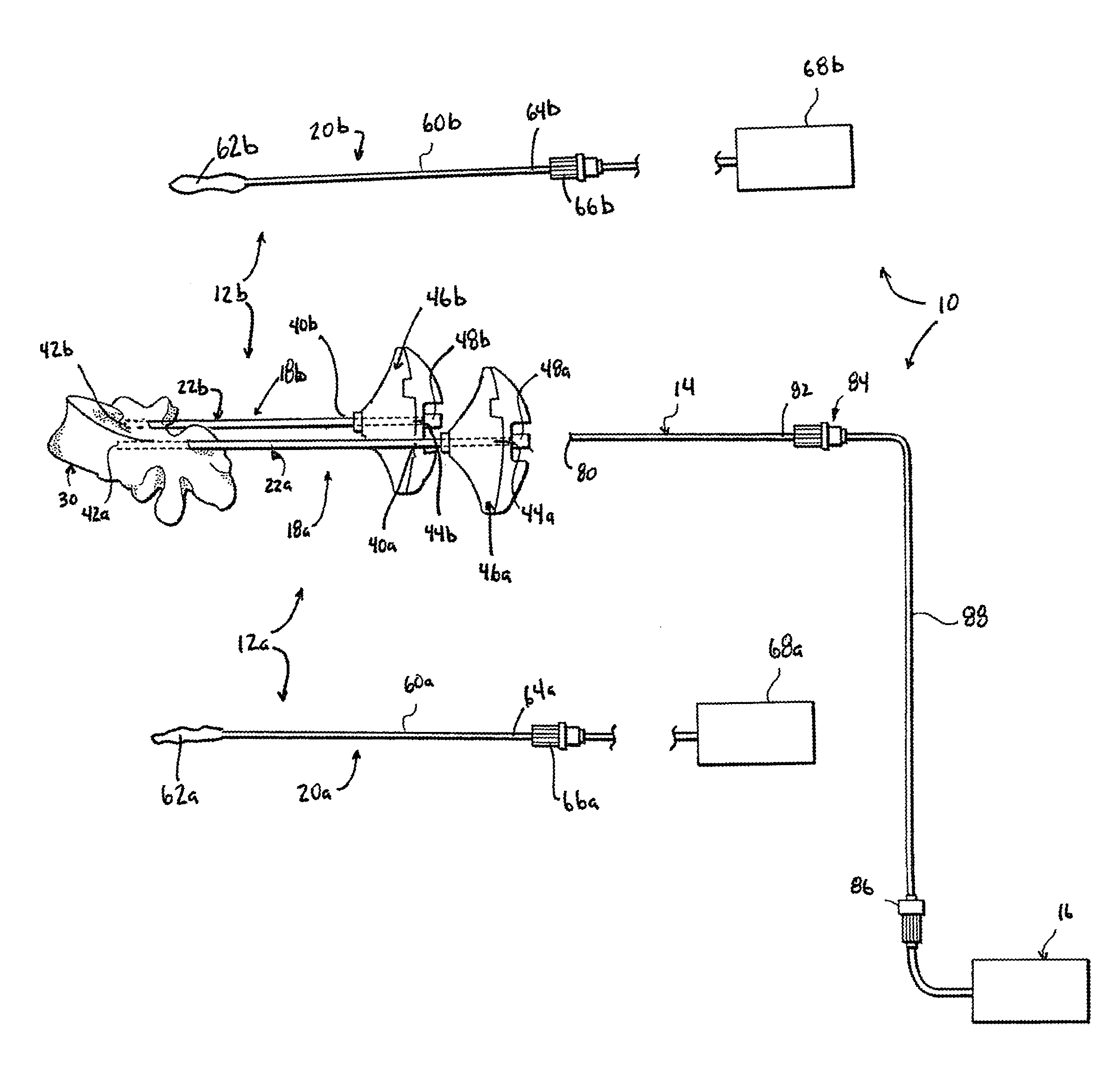 Apparatus and method for stylet-guided vertebral augmentation