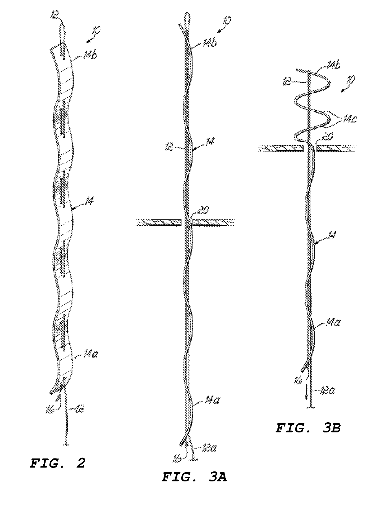 Devices for treating paravalvular leakage and methods use thereof