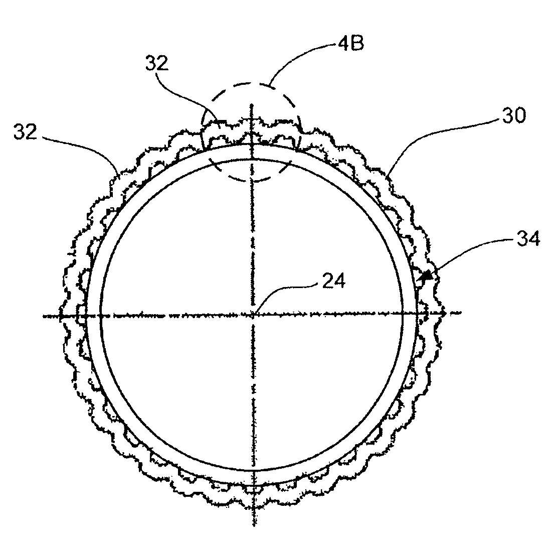 Corrugated expansion-constraining sleeve for an inflatable penile prosthesis cylinder