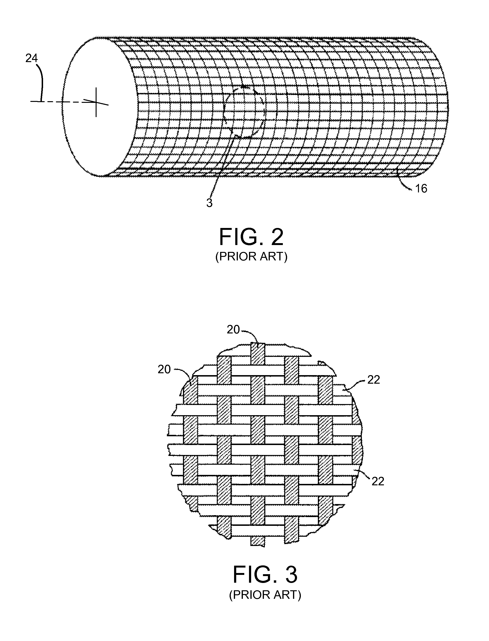 Corrugated expansion-constraining sleeve for an inflatable penile prosthesis cylinder