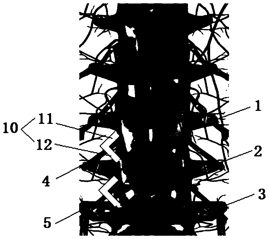 Preparation method and application of rat chronic dorsal root neurothlipsis model