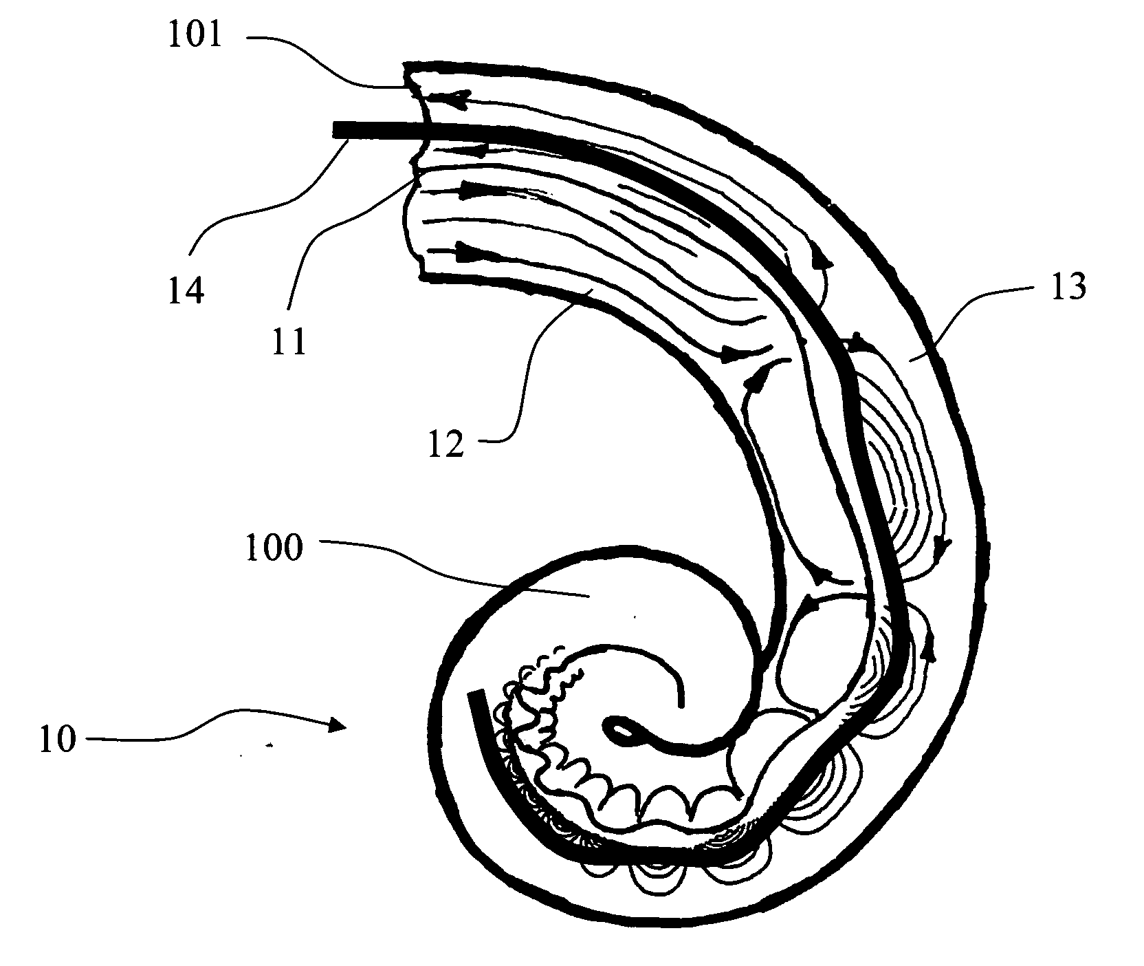 Improvements for cochlear implants