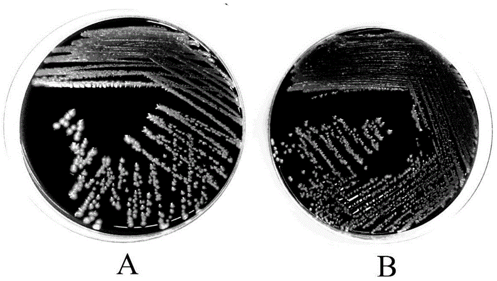 Trypsin digestive juice, preparation method and ready-to-use phlegm digesting device