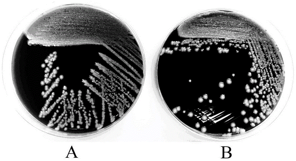 Trypsin digestive juice, preparation method and ready-to-use phlegm digesting device