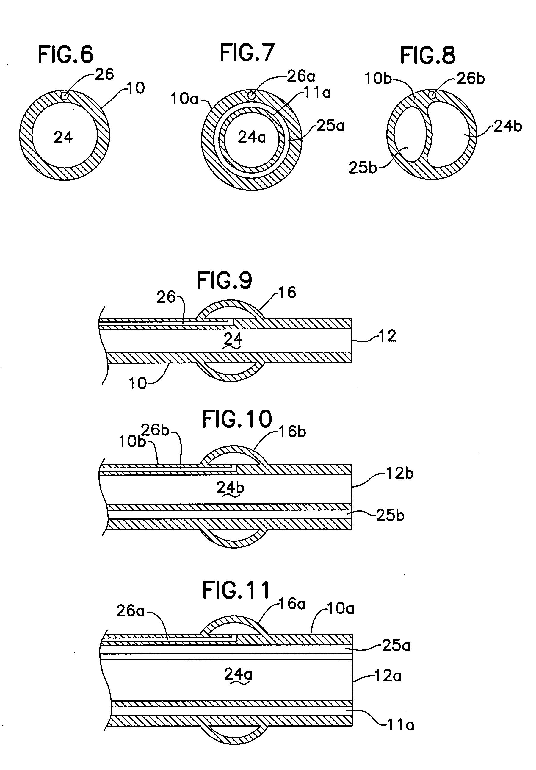 Visualization of coronary vein procedure