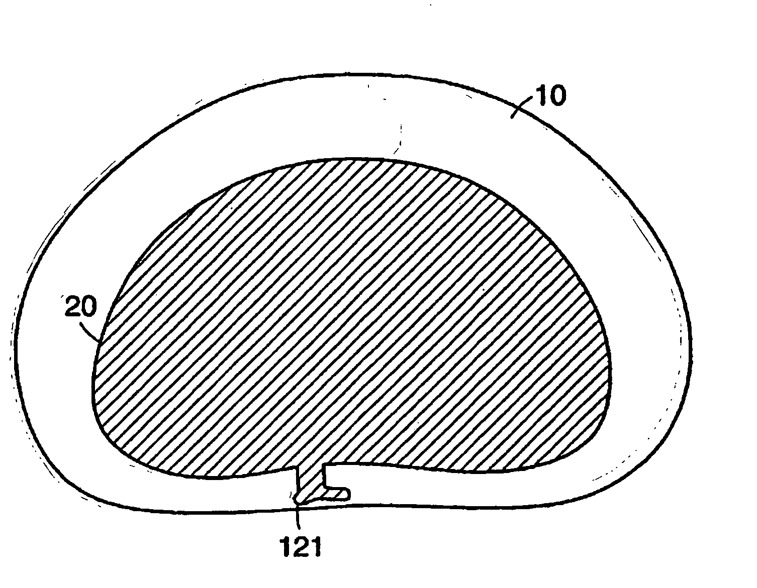 Method of implanting a dynamically stable spinal implant