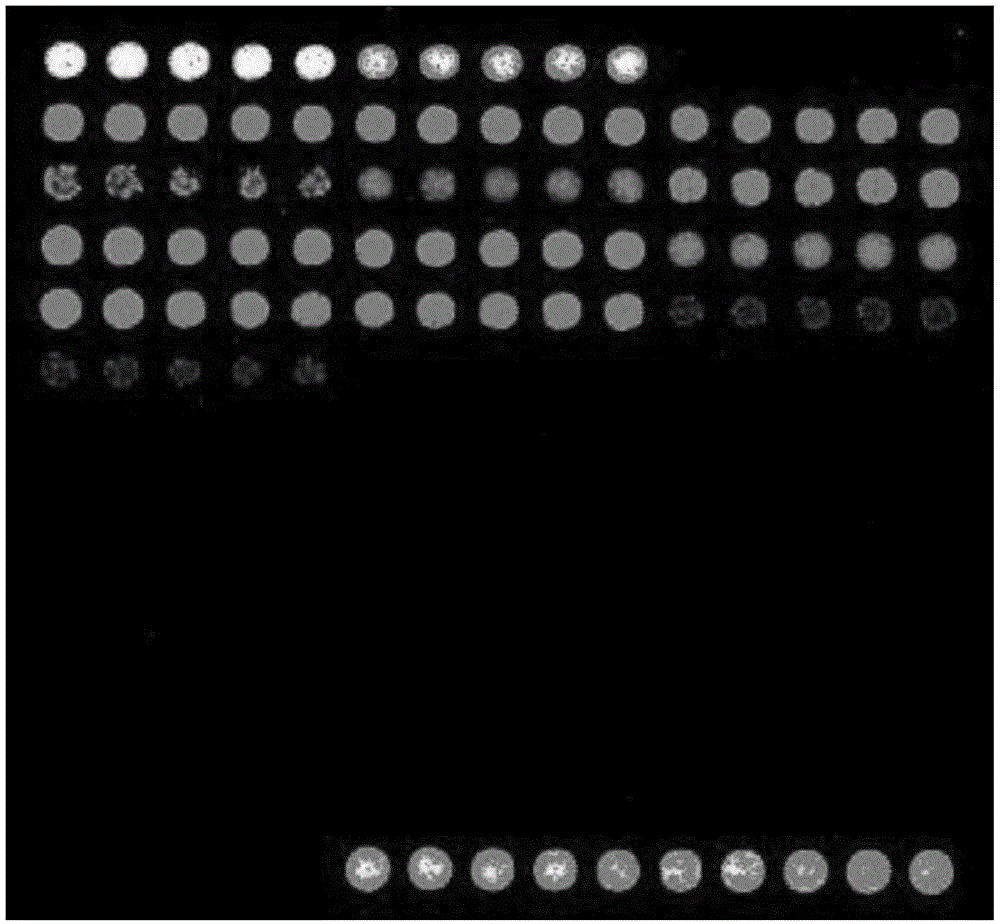 Gene chip for detection of cerebrospinal fluid pathogens