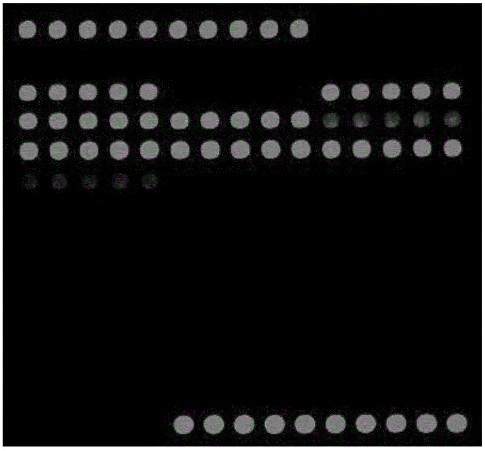 Gene chip for detection of cerebrospinal fluid pathogens