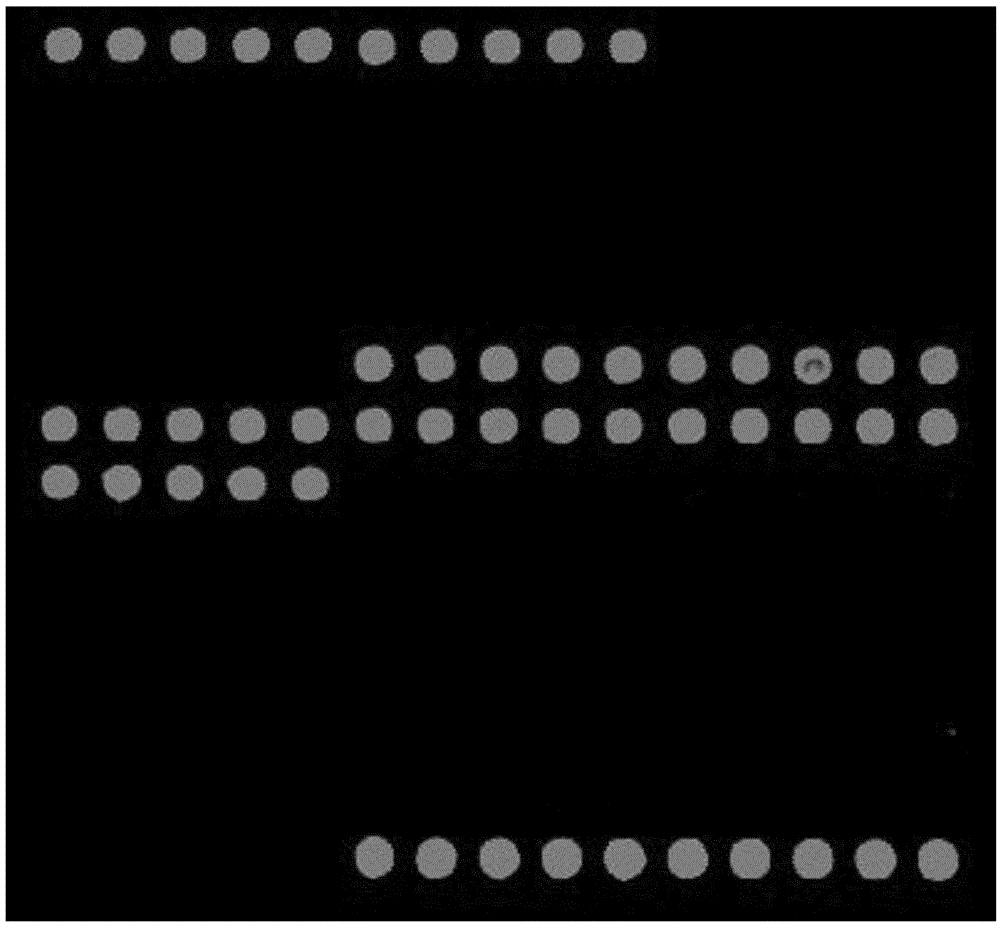 Gene chip for detection of cerebrospinal fluid pathogens