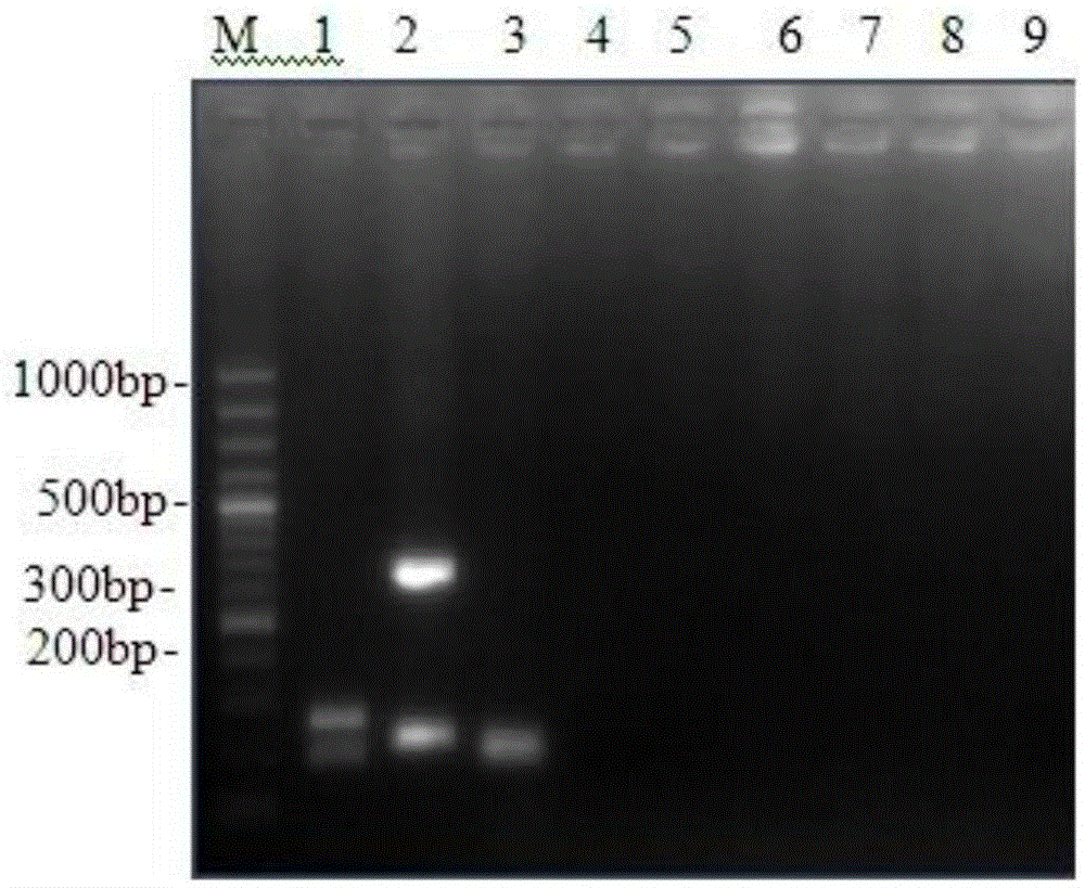 Kit for RT-PCR typing detection of avian infectious bronchitis virus