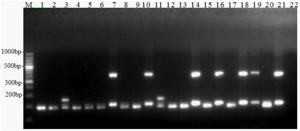 Kit for RT-PCR typing detection of avian infectious bronchitis virus