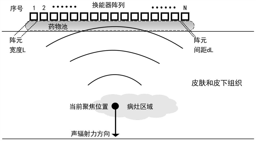 Ultrasonic circulating focusing emission transdermal drug delivery device and control method