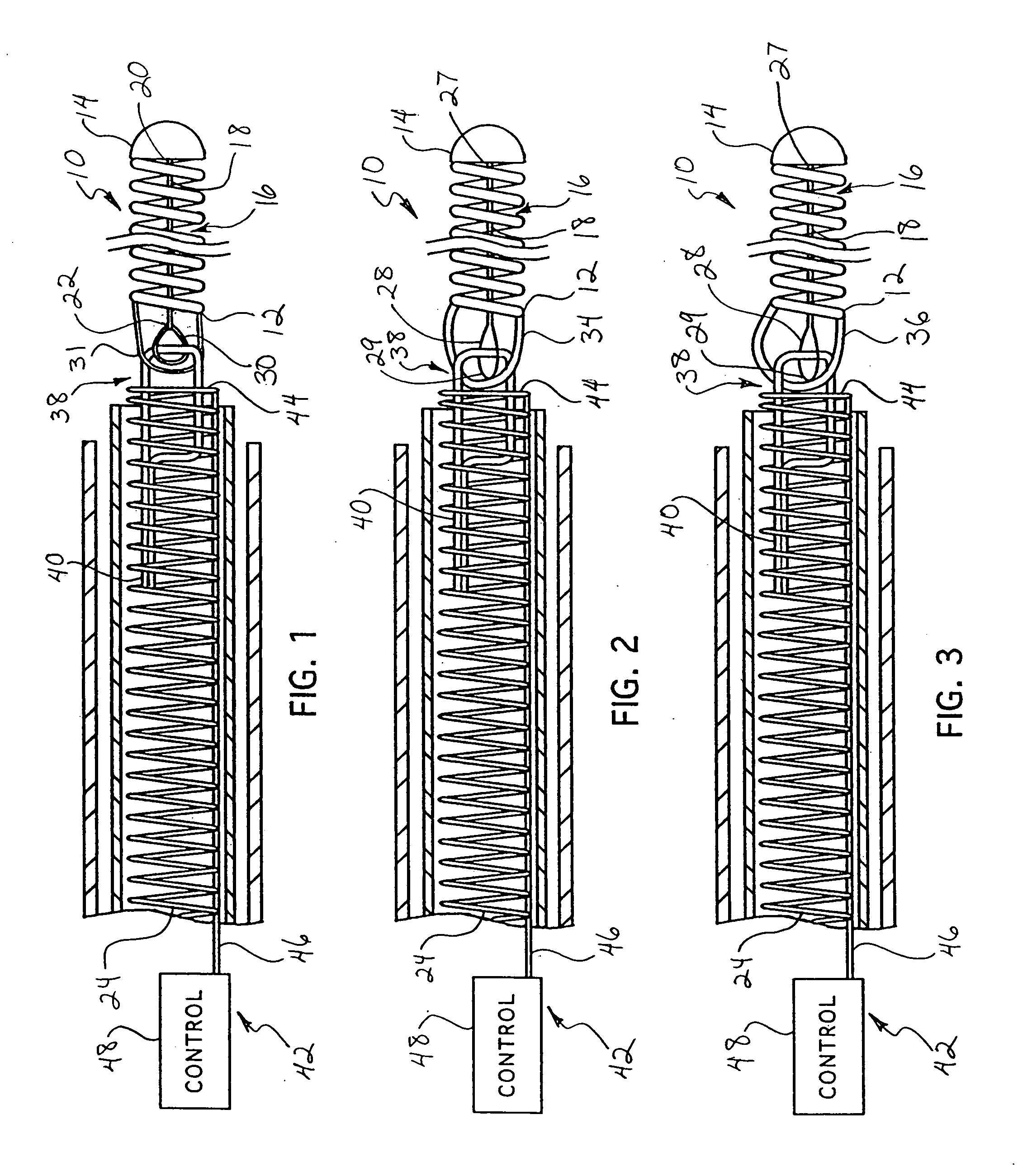 Stretch resistant therapeutic device