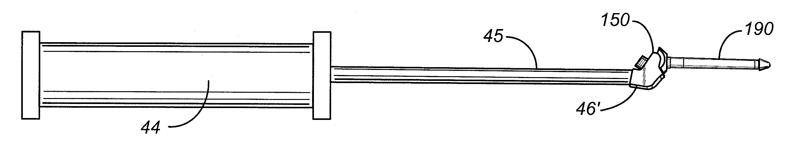 Facet replacement device removal and revision systems and methods