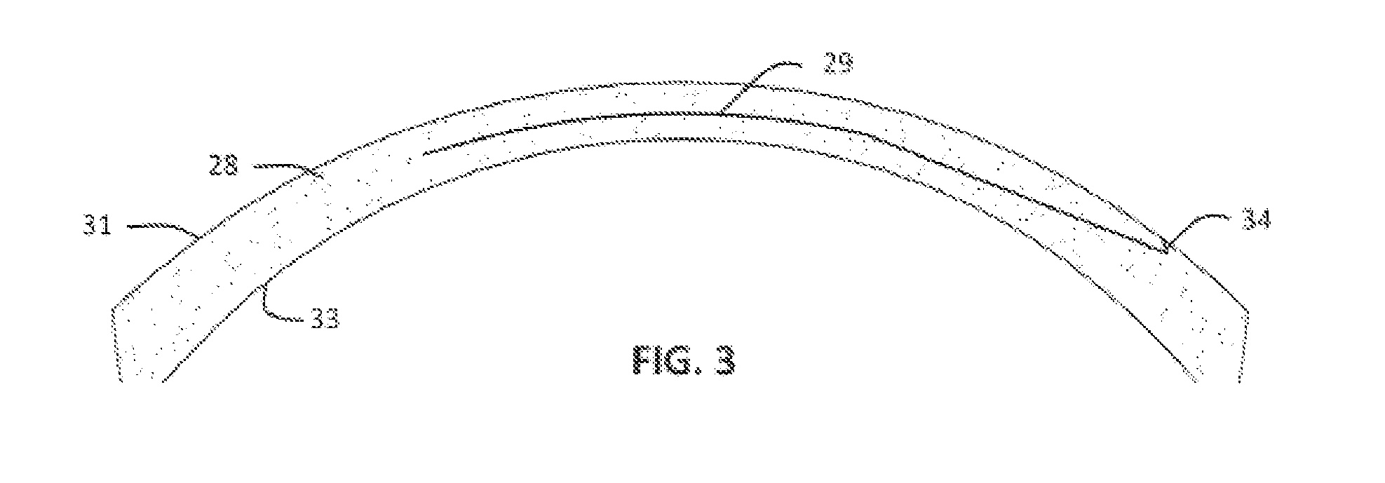 Method for Laser Cutting a Corneal Pocket