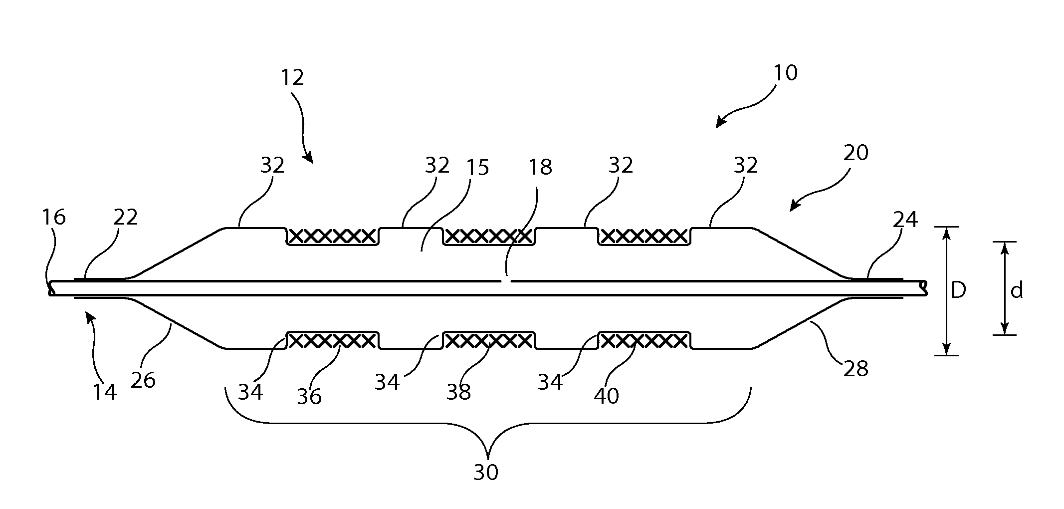 Delivery system for implantable medical device