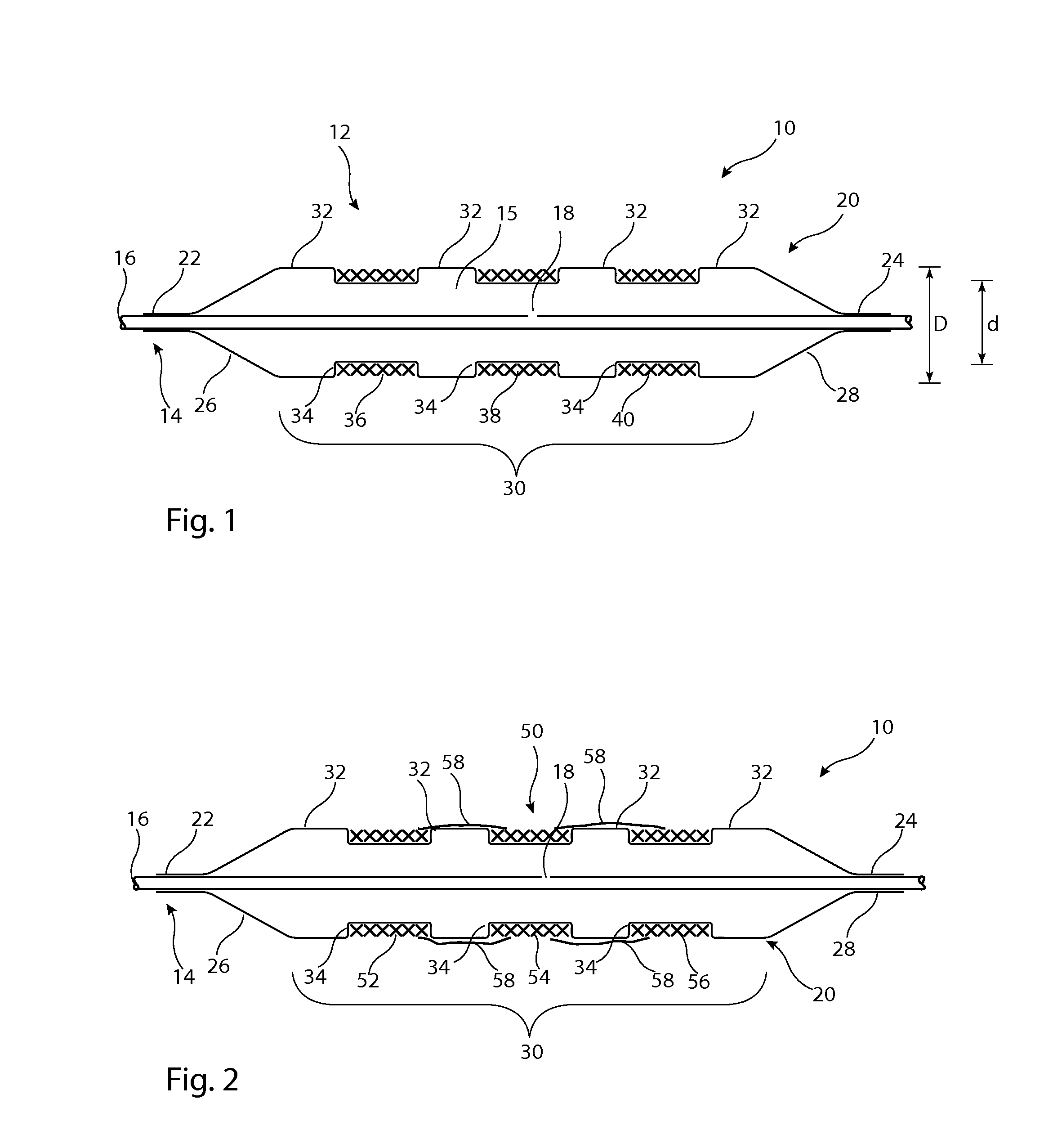 Delivery system for implantable medical device