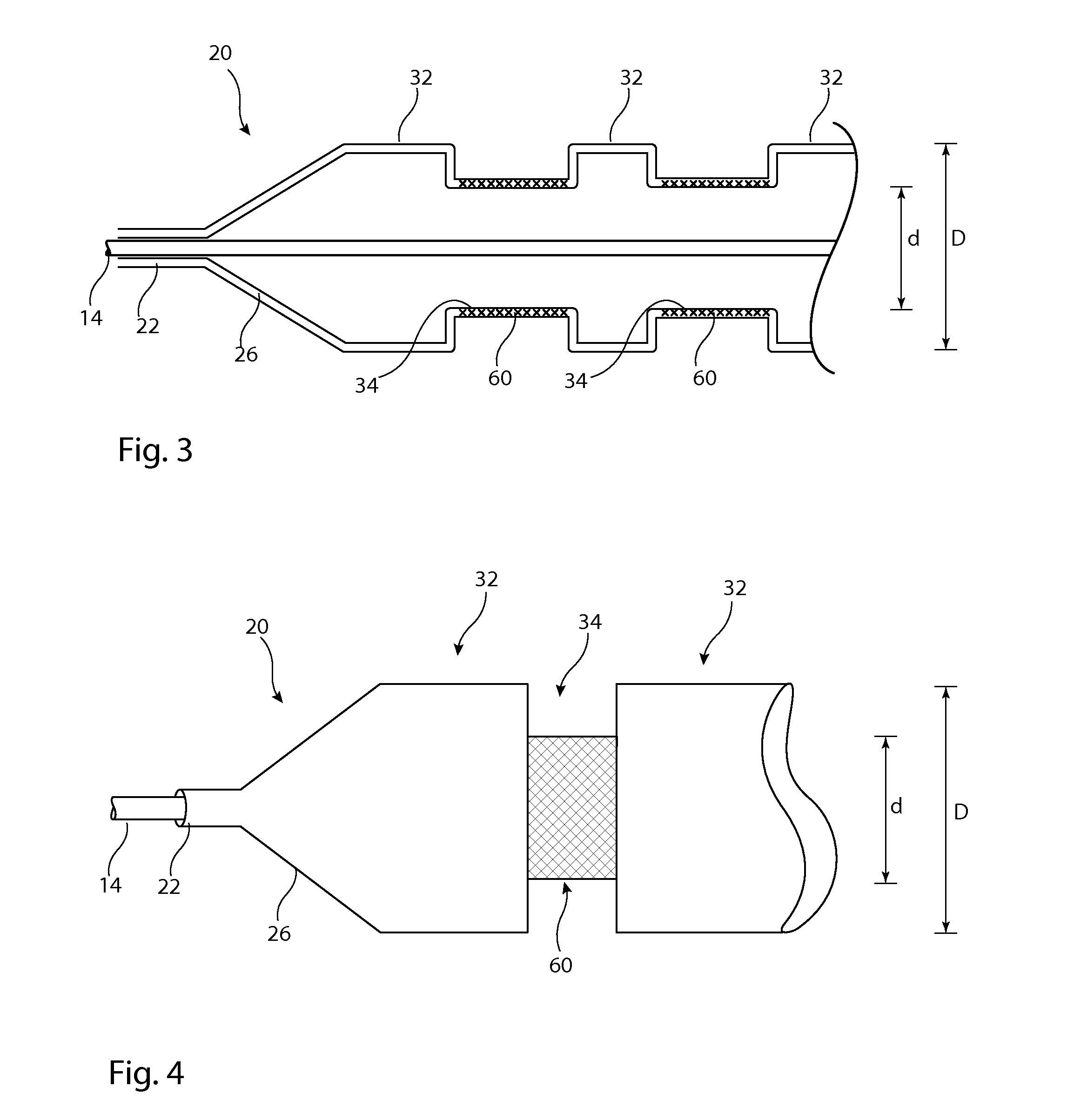 Delivery system for implantable medical device