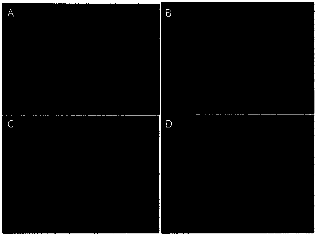 Cryopreservation method for adipose tissues