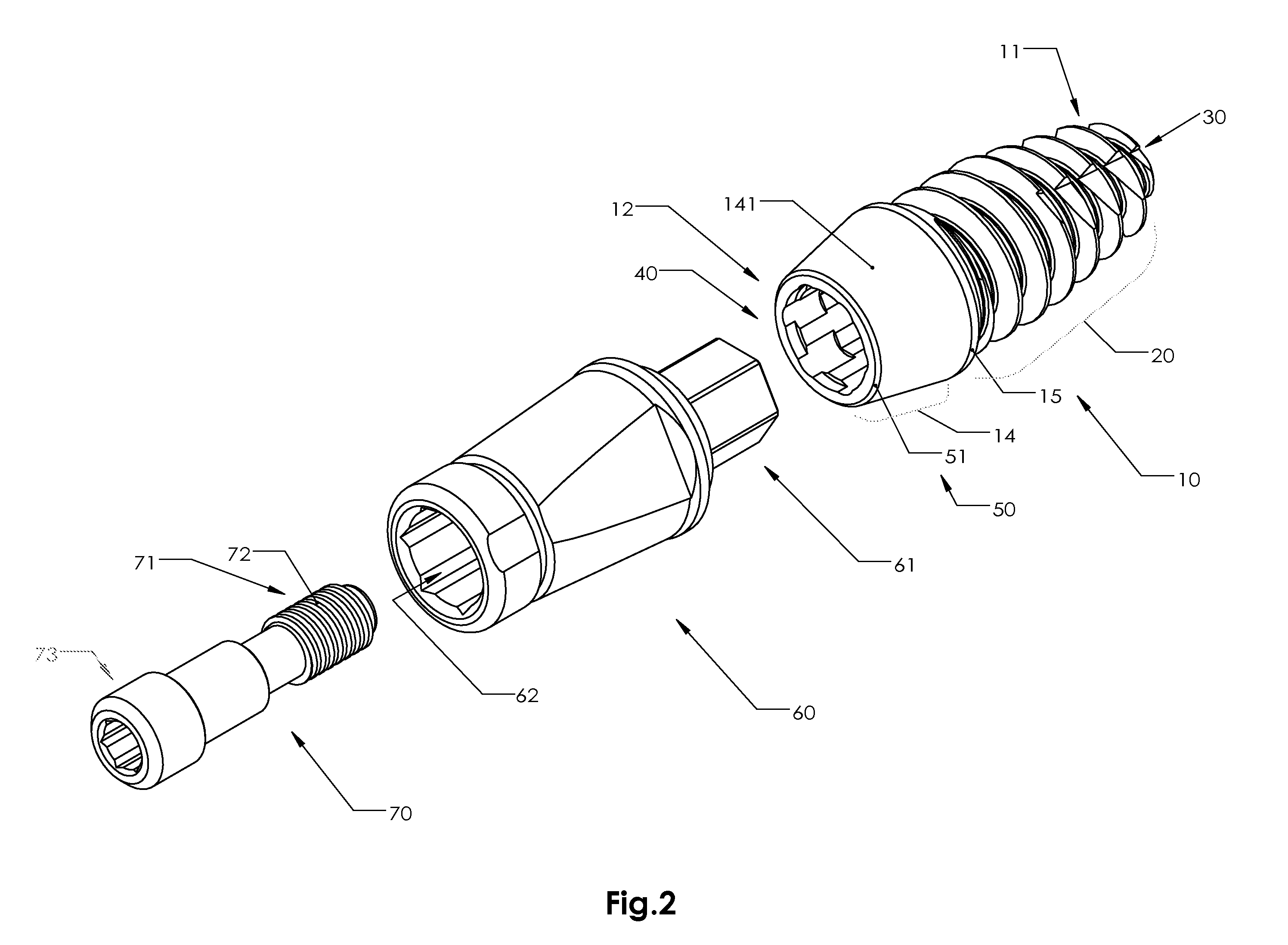 Dental Implant