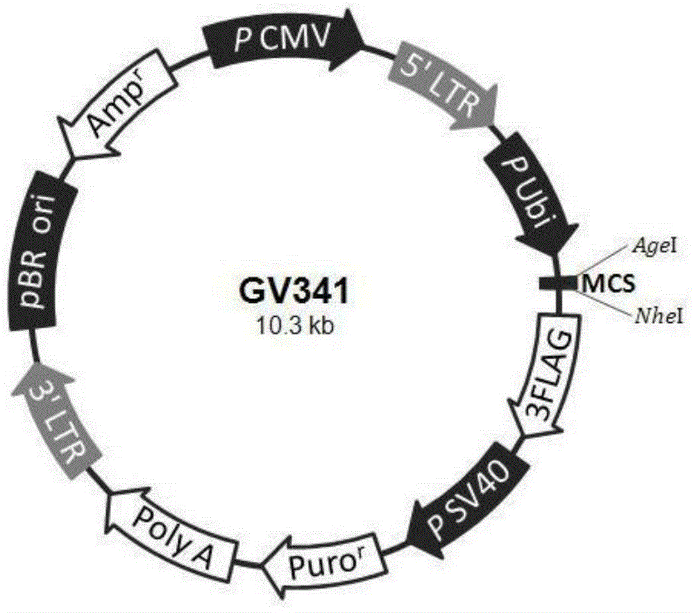 Immortalized human liver cancer blood vessel endothelial cell line and preparation method and application thereof