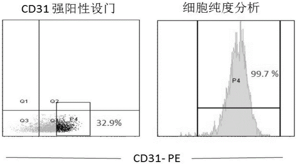 Immortalized human liver cancer blood vessel endothelial cell line and preparation method and application thereof