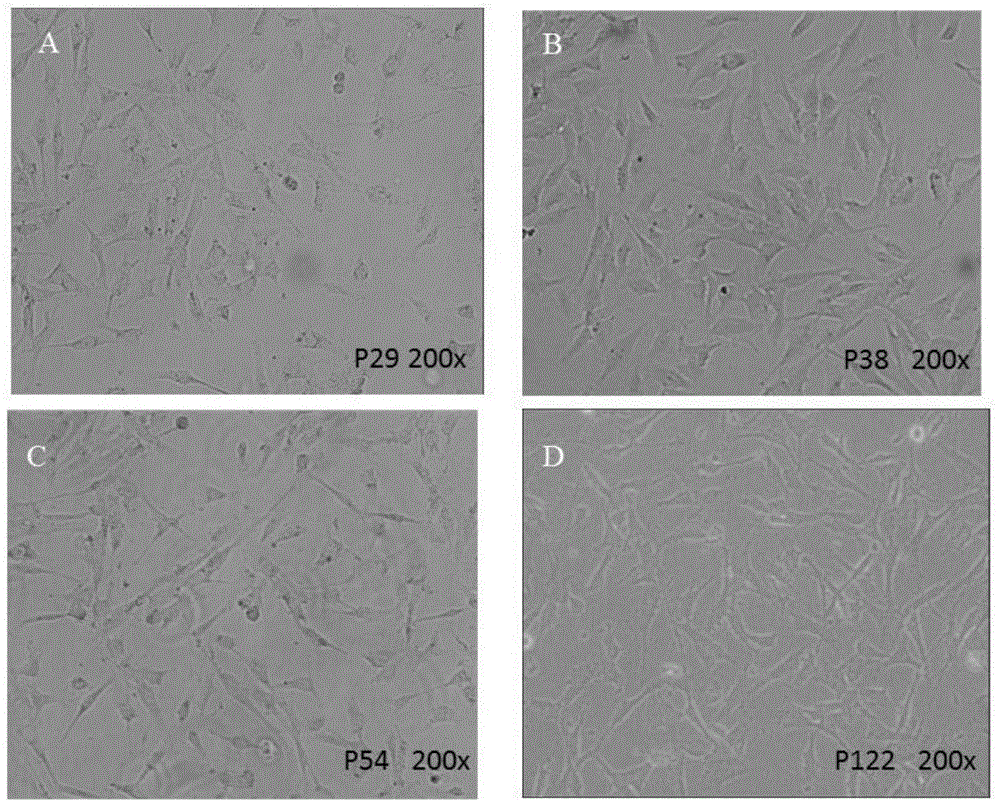 Immortalized human liver cancer blood vessel endothelial cell line and preparation method and application thereof