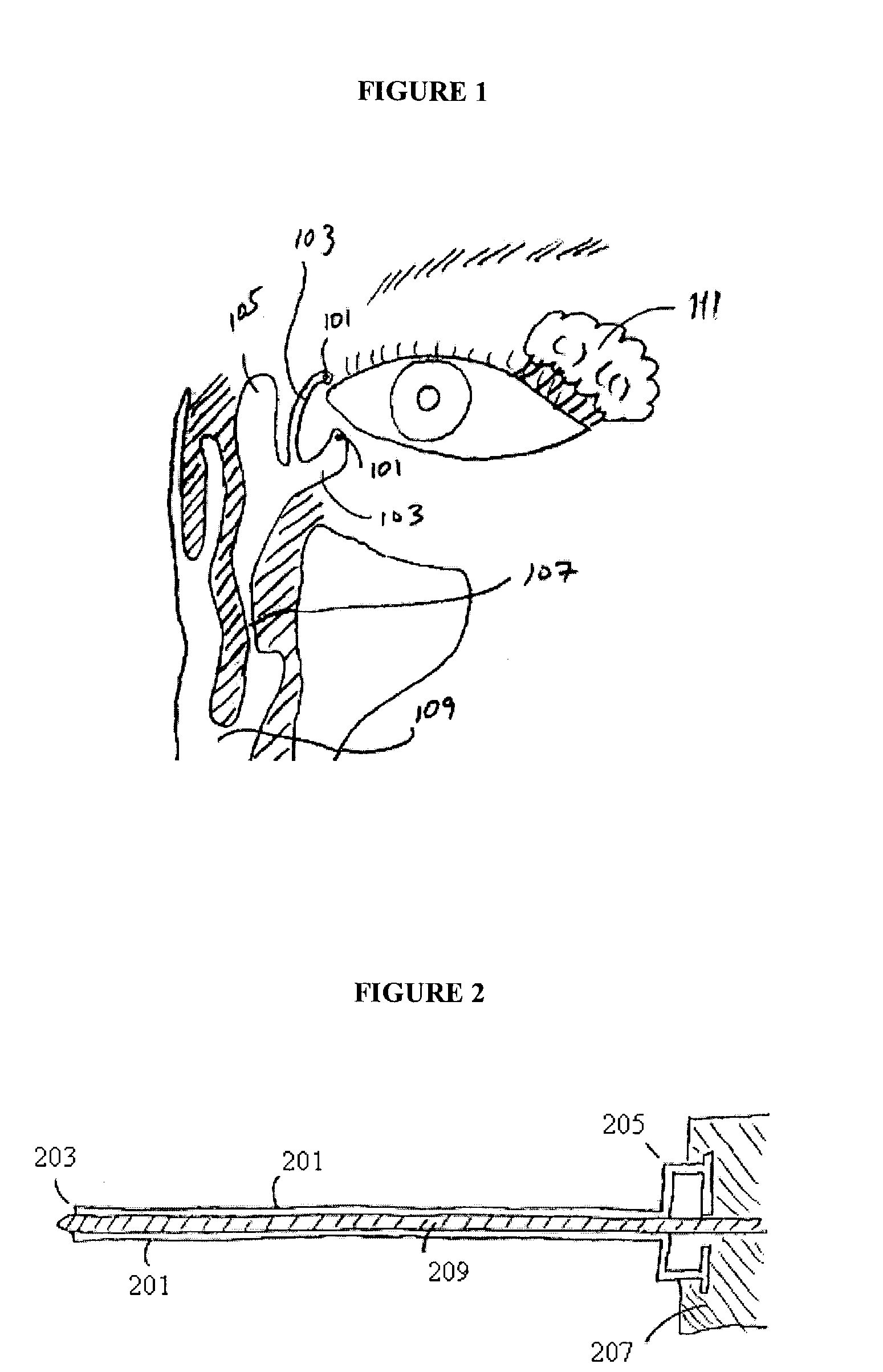 Device and method for dacryocystorhinostomy