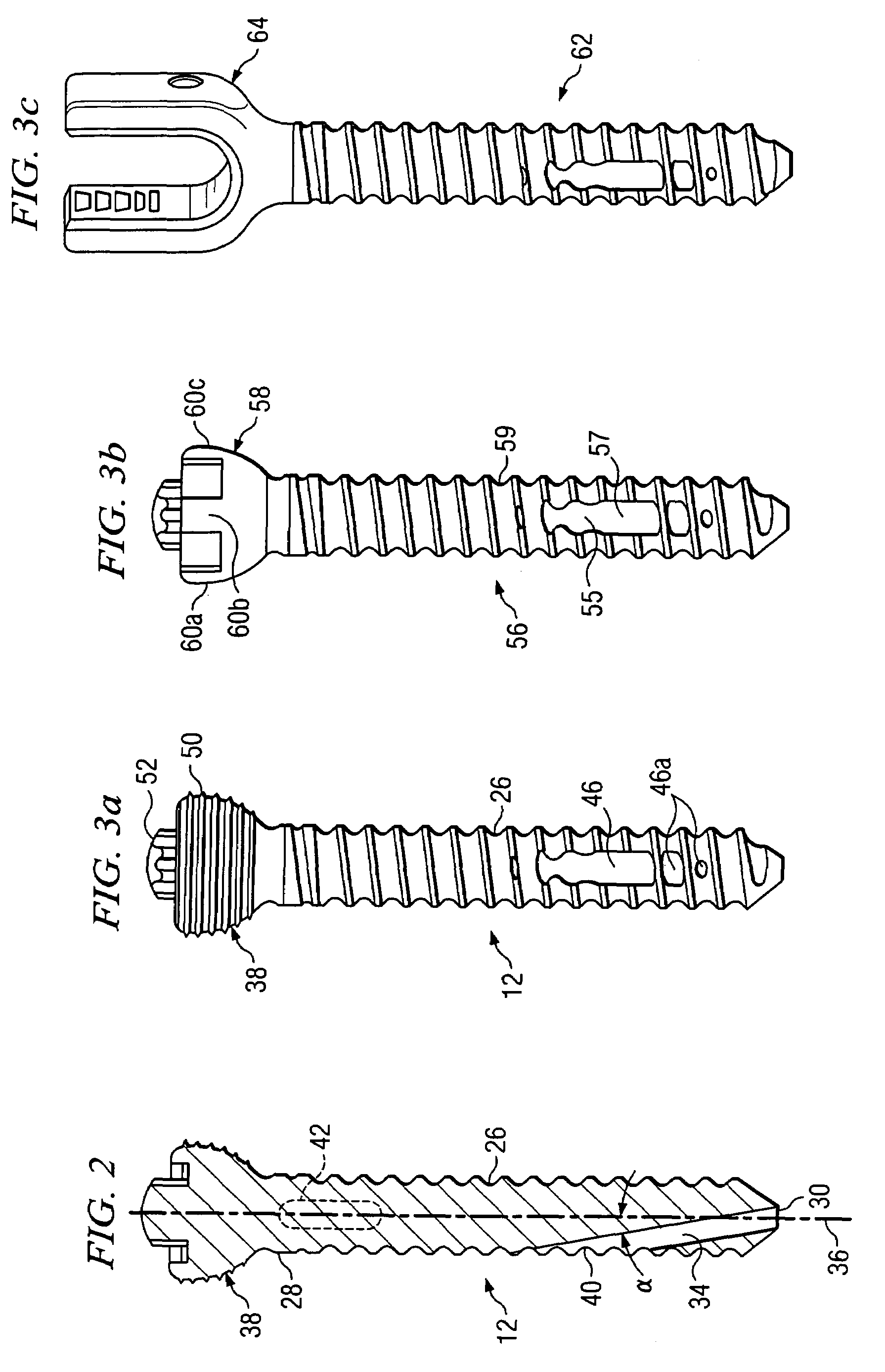 Off-axis anchor guidance system