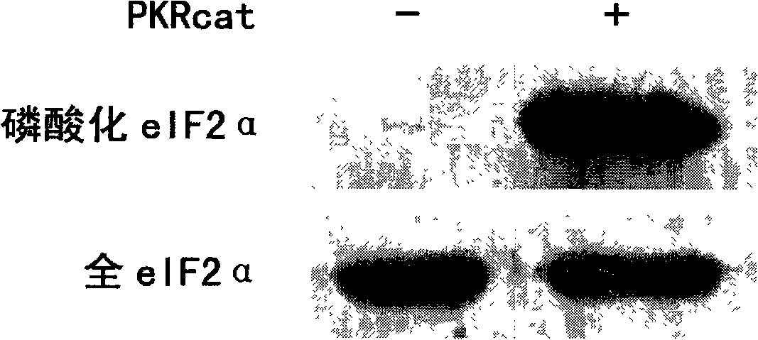 Polypeptide combinative with PKR kinase structure field specificity and uses thereof