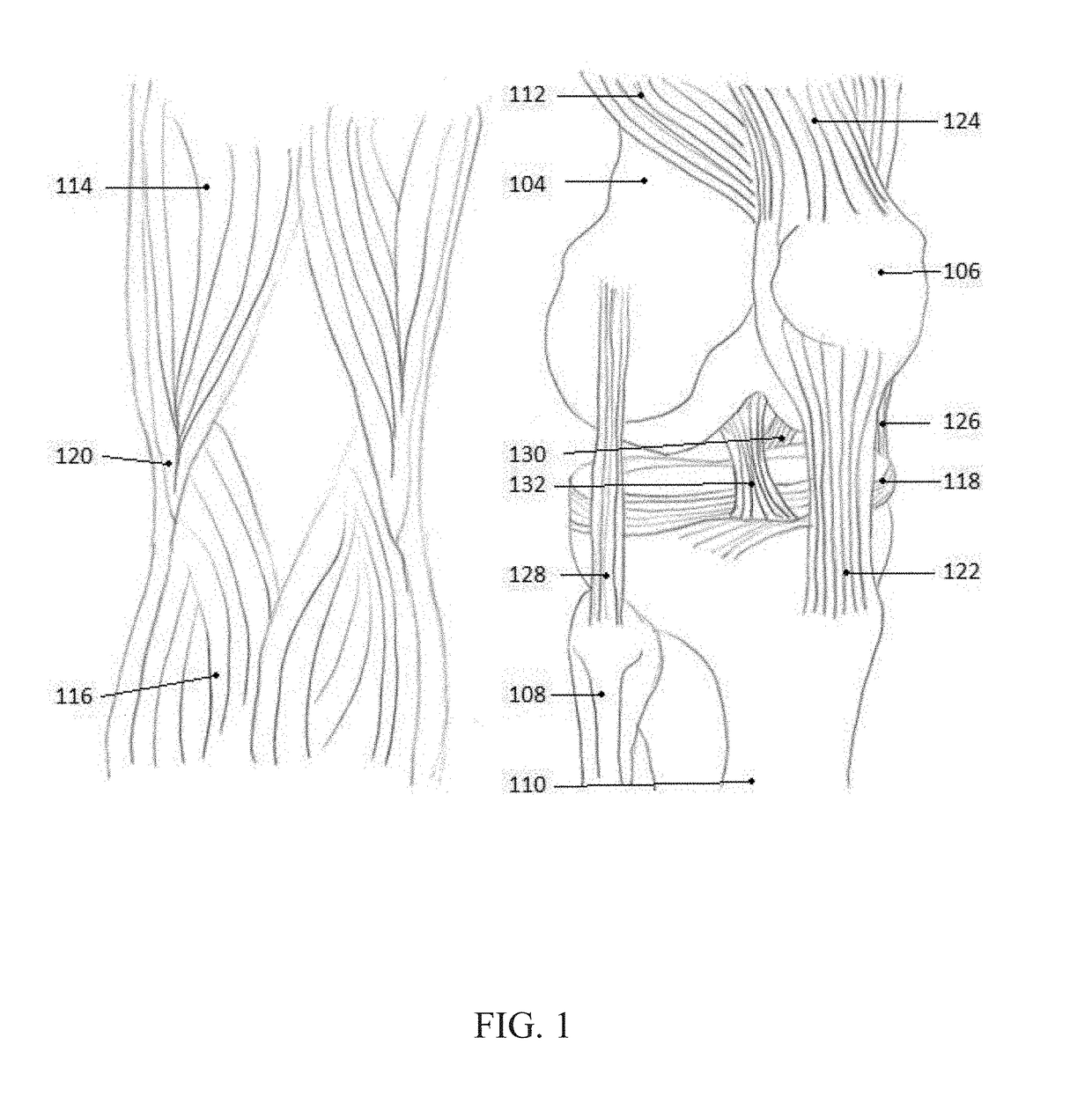 System and method for a wearable knee injury prevention