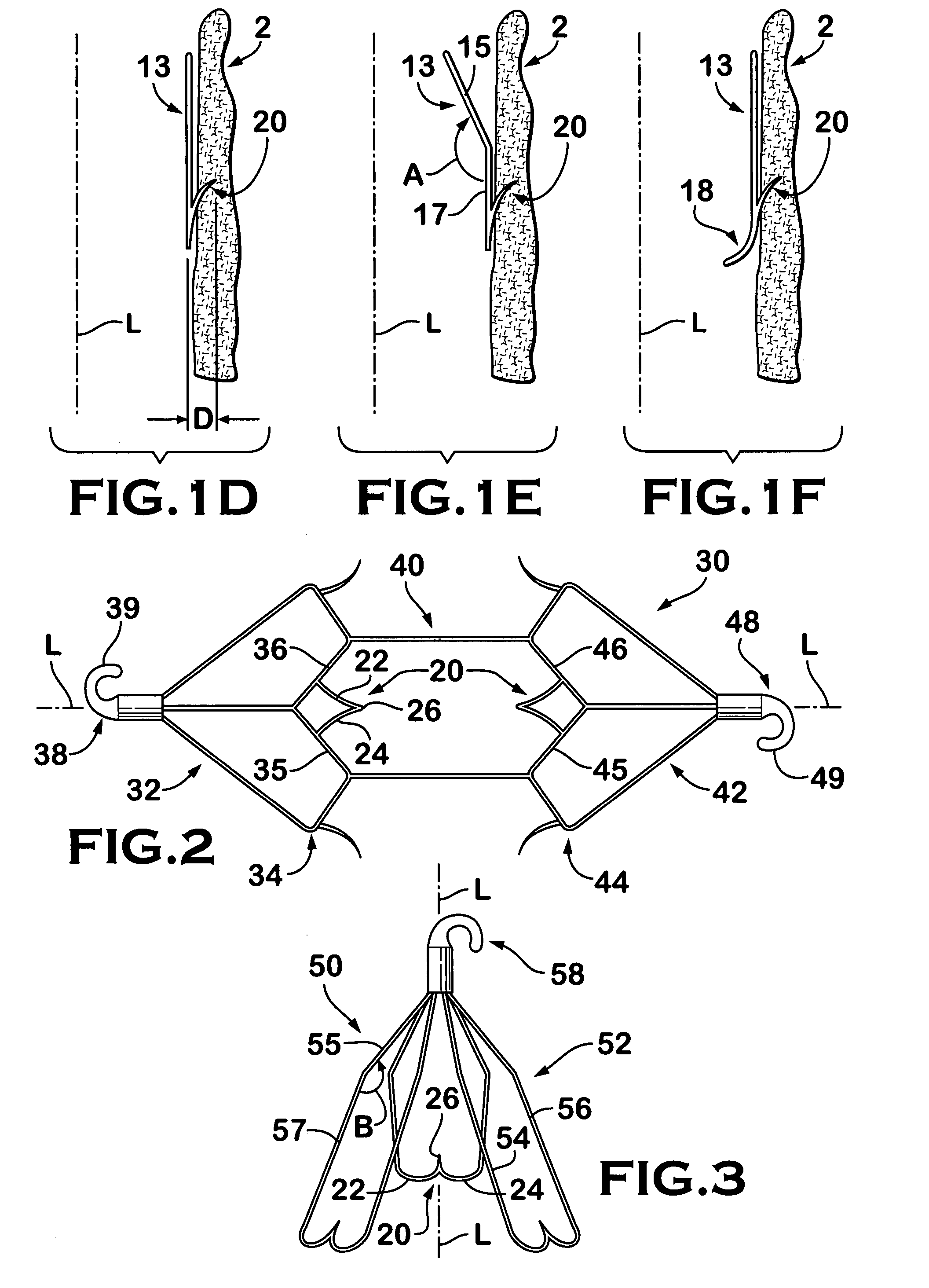 IVC filter with translating hooks