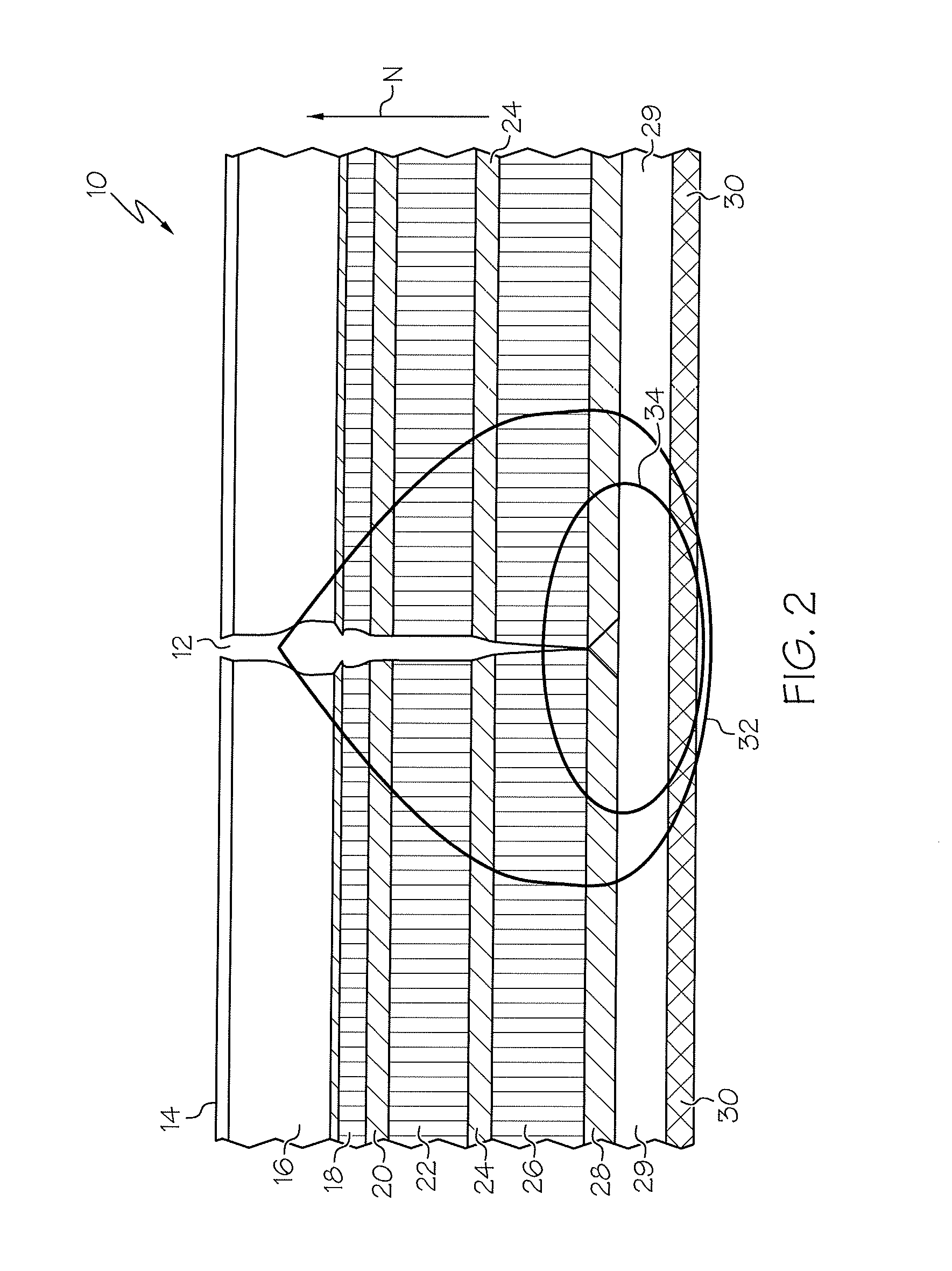 Laparoscopic wound closure device