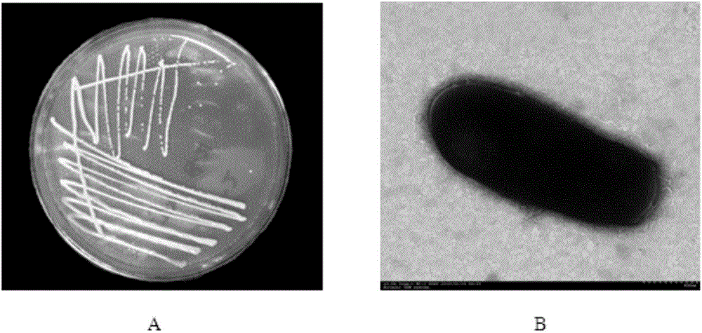 17 beta-estradiol degrading strain and application thereof