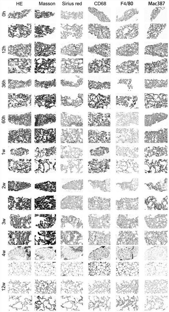 Method for establishing pulmonary fibrosis rhesus monkey model