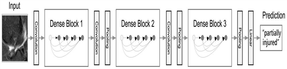 Knee joint cartilage injury detection method and system