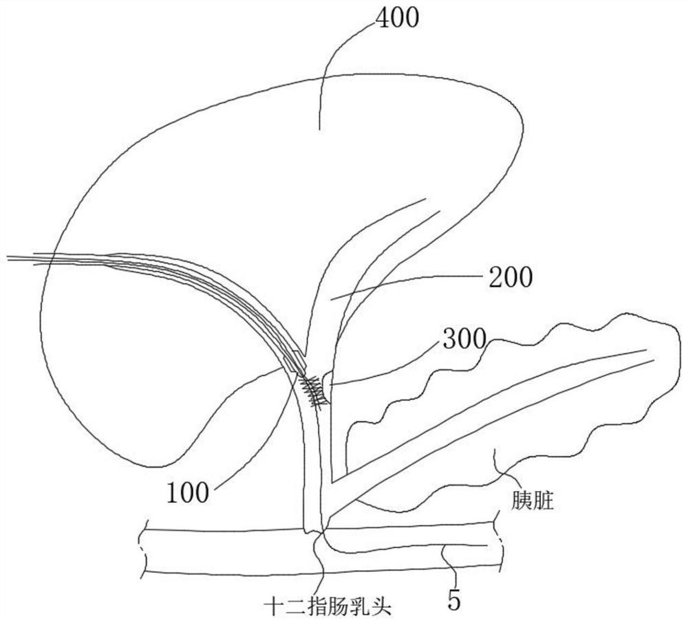 Biliary tract cytology brush based on PTC approach and use method thereof