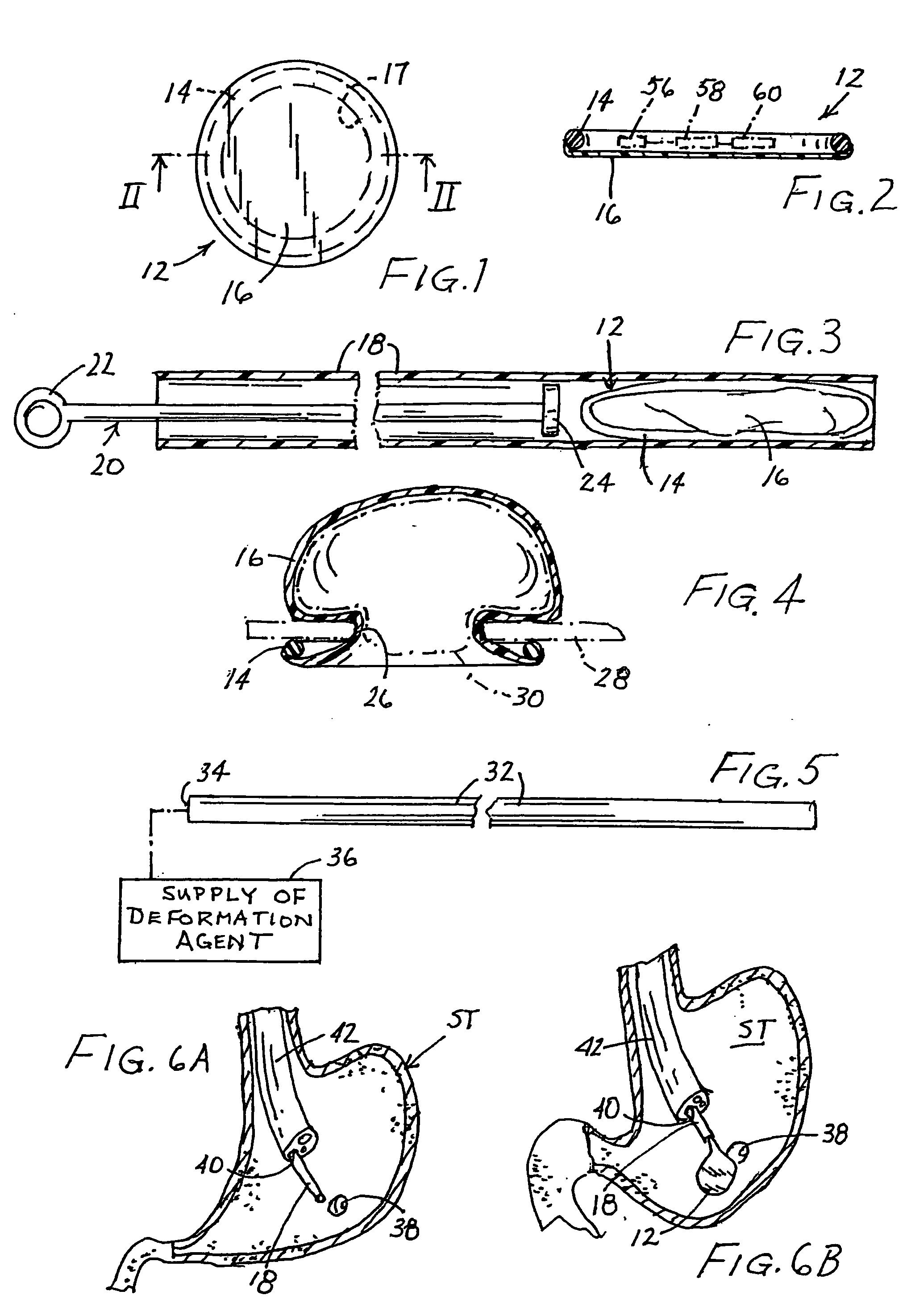 Surgical kit, closure device, and associated method