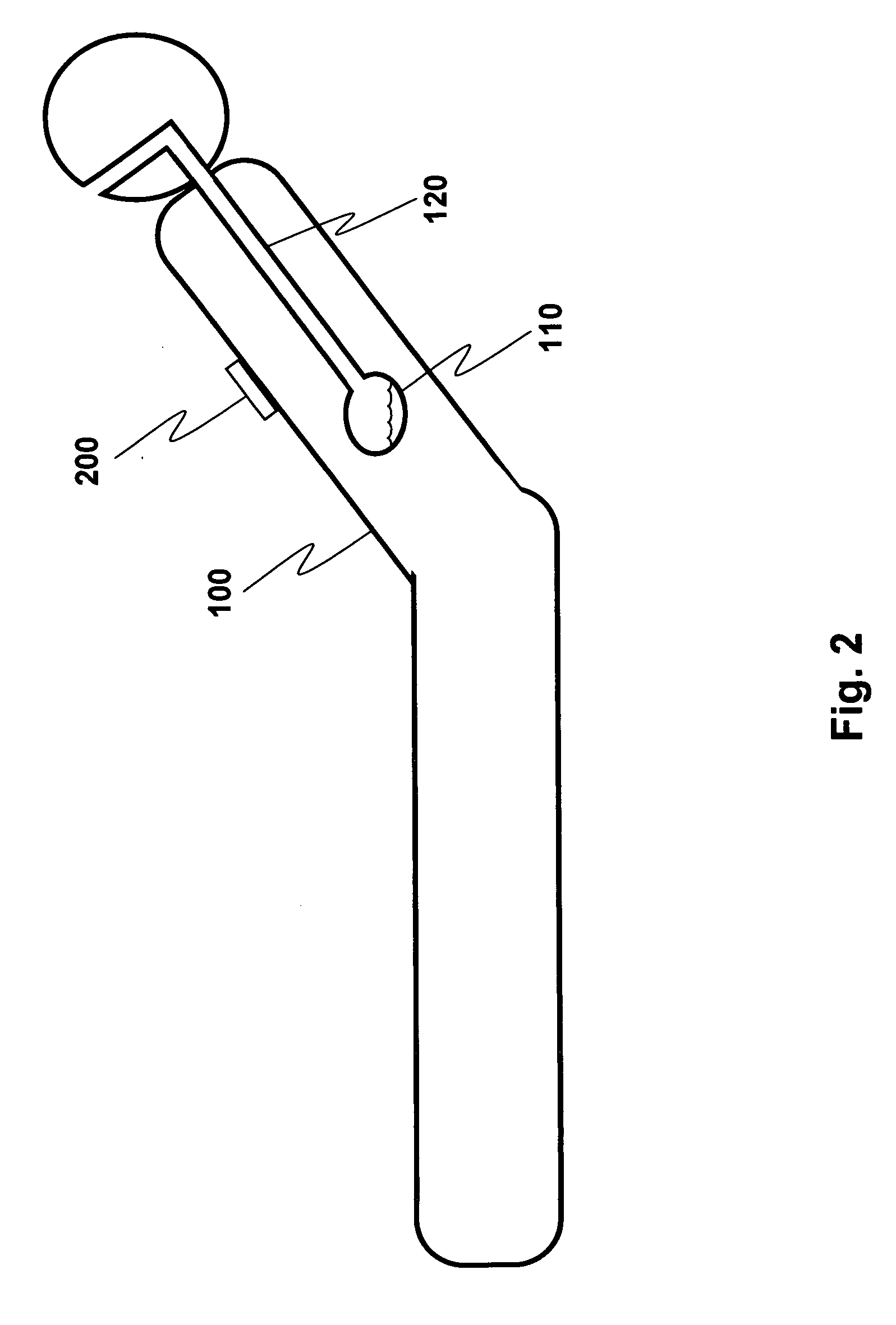 Retrofittable aspiration prevention mechanism for patients