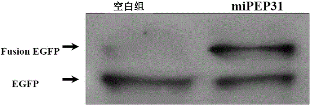 Application of micro RNA31 precursor coded polypeptide to preparation of immunoregulation medicament