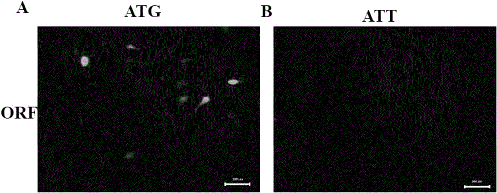 Application of micro RNA31 precursor coded polypeptide to preparation of immunoregulation medicament