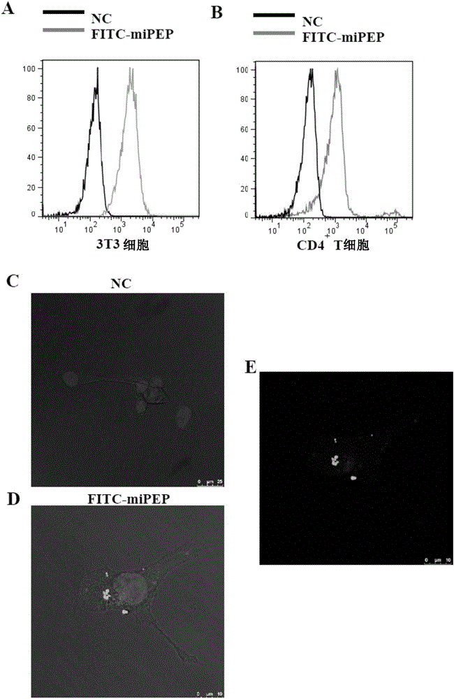 Application of micro RNA31 precursor coded polypeptide to preparation of immunoregulation medicament